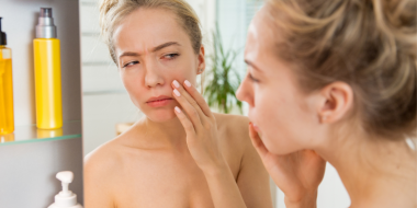 The Best Moisturisers for Acne-Prone Skin